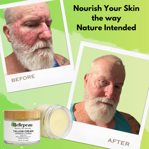 Tallow Cream Hydrating & Healing for Dry or Damaged Skin