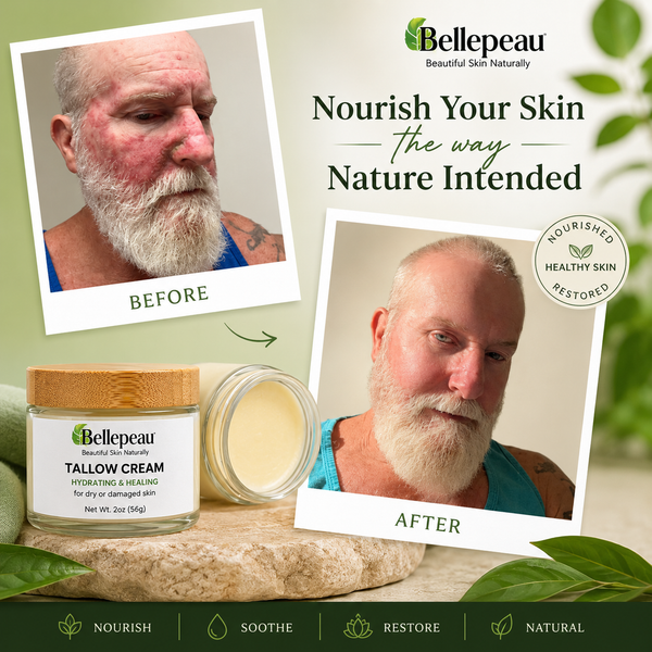 Tallow Cream Hydrating & Healing for Dry or Damaged Skin